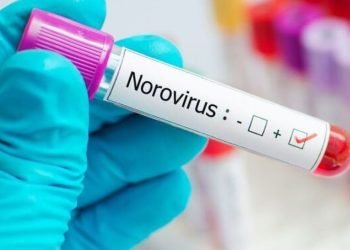 AFIRMA SESA: Ningún caso de Norovirus en QR hasta el momento