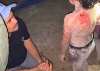 HUYEN LOS DUEÑOS: Ataca perro rottweiler a niño en Playa del Carmen