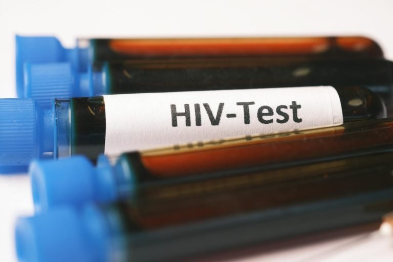 Veracruz: Alerta por aumento de casos de VIH en jóvenes y amas de casa