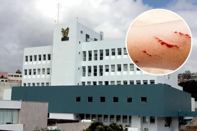 Tragedia por rabia en Zacatecas: Joven muere tras mordedura de zorrillo