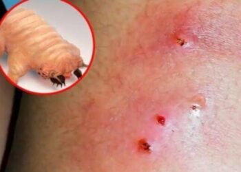 Alerta sanitaria en Yucatán: Confirman segundo caso humano de gusano barrenador