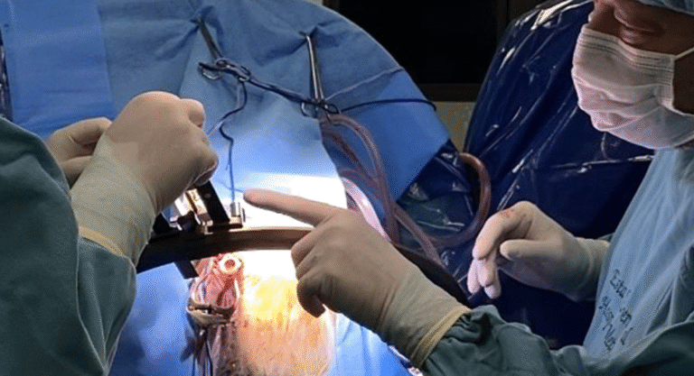 La marina de México avanza en el tratamiento del párkinson con cirugía cerebral de vanguardia