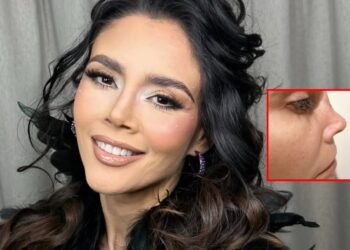 Dorismar, cirugía estética fallida Dorismar, José Achar, rinoplastia fallida, Salvador Padilla