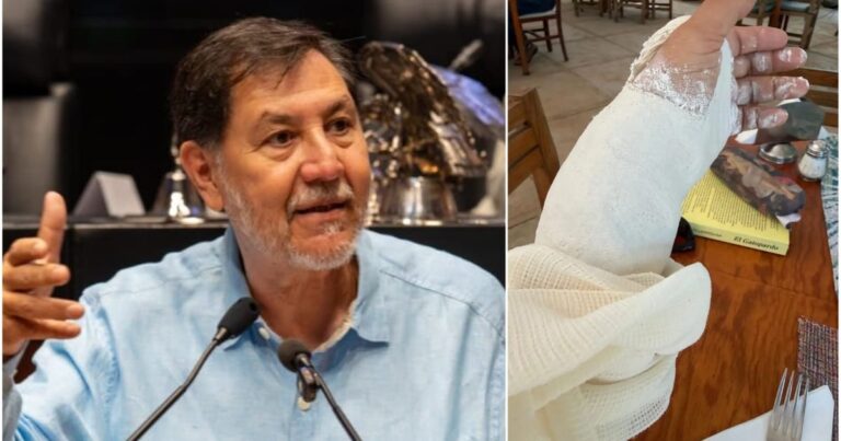 Gerardo Fernández Noroña sufre fractura tras caída en Tepoztlán