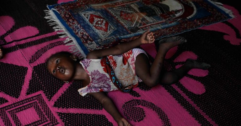 El impacto de la guerra en Irán sobre la desnutrición infantil en Nigeria