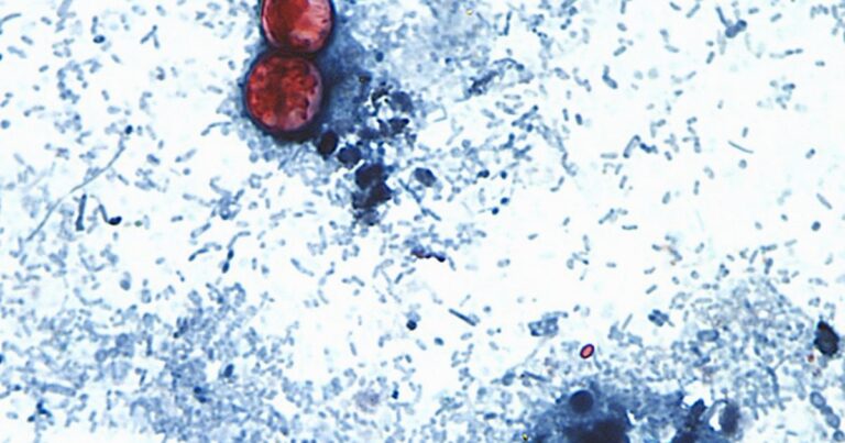 Inspección de la FDA en declive agrava crisis por cyclospora en lechuga importada