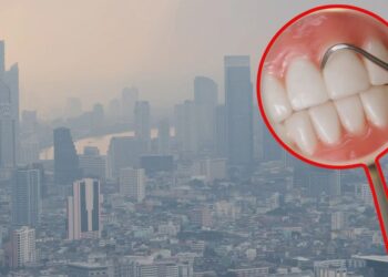 Universidad Estatal Paulista detecta daño en encías por PM2.5