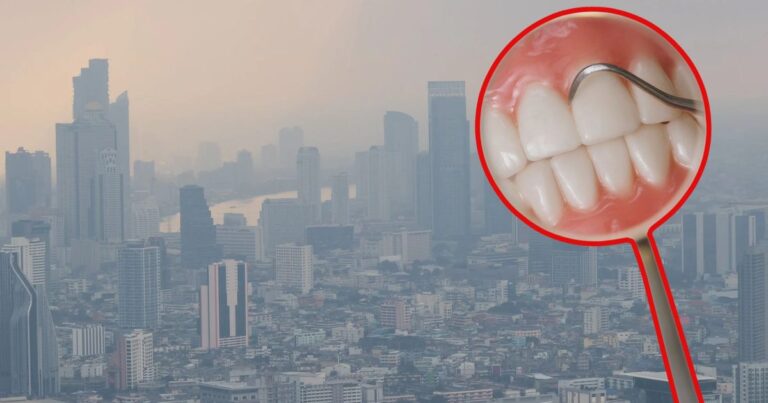 Universidad Estatal Paulista detecta daño en encías por PM2.5
